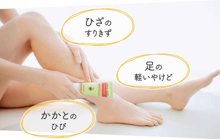 ひざのすりきず 足の軽いやけど かかとのひび イメージ