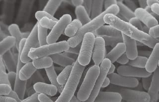 乳酸菌ONRICb0240顕微鏡画像